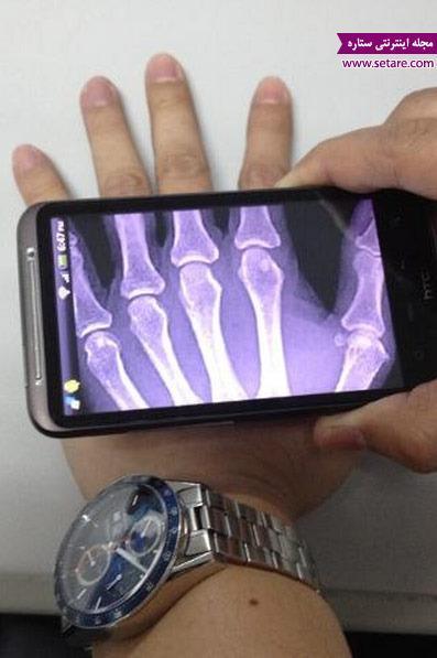 تکنولوژی جدید موبایل برای دریافت عکس رادیولوژی