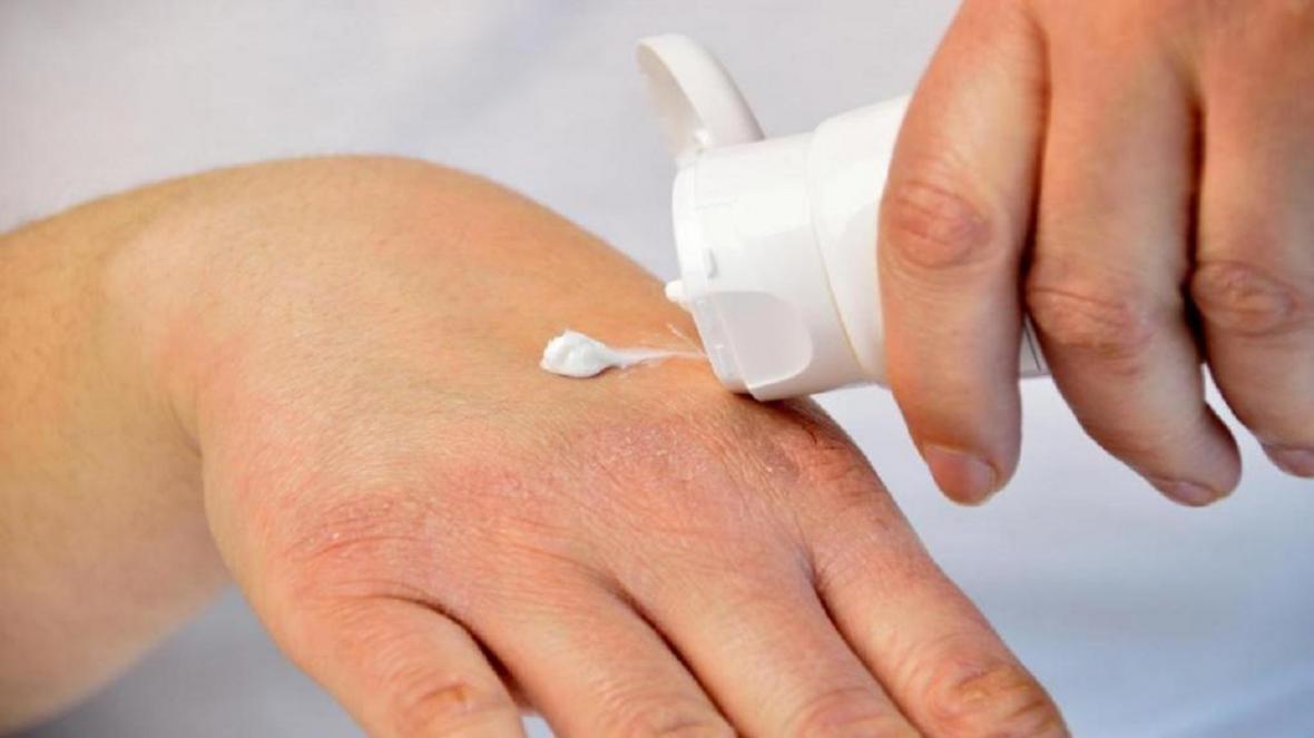 ویروس کرونا؛ چگونه پوست دست را از خشک شدن نجات دهیم؟
