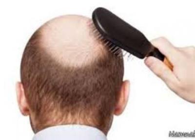 درمان طبی ریزش مو درمان طبی ریزش مو